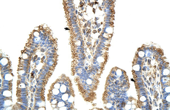 KARS Rabbit Polyclonal Antibody