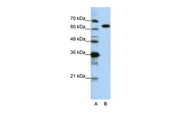 KARS Rabbit Polyclonal Antibody