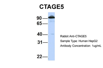 MIA2 Rabbit Polyclonal Antibody