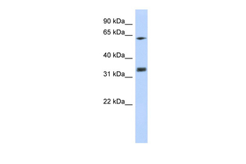 RACK1 Rabbit Polyclonal Antibody