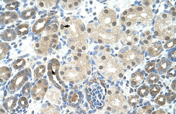 PPIE Rabbit Polyclonal Antibody