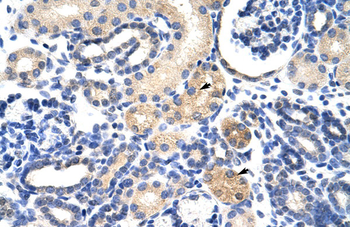 EMG1 Rabbit Polyclonal Antibody