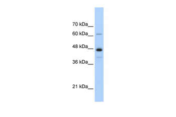 NXF1 Rabbit Polyclonal Antibody