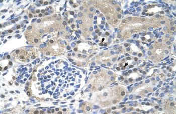 NXF1 Rabbit Polyclonal Antibody