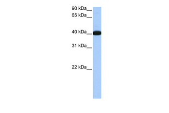 NOL5A Rabbit Polyclonal Antibody