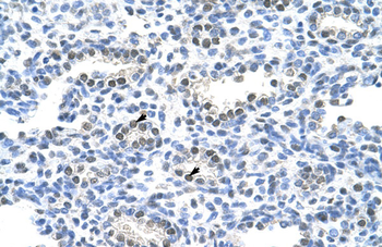 PAIP1 Rabbit Polyclonal Antibody