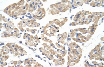 FARS2 Rabbit Polyclonal Antibody