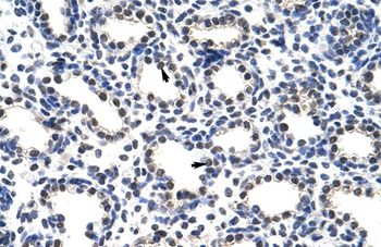 POP4 Rabbit Polyclonal Antibody