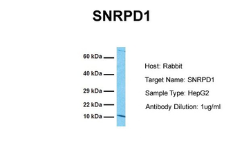 SNRPD1 Rabbit Polyclonal Antibody