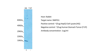 SNRPD1 Rabbit Polyclonal Antibody