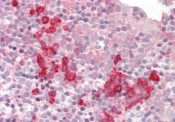 SNRPD1 Rabbit Polyclonal Antibody