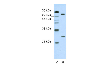 NUDT21 Rabbit Polyclonal Antibody