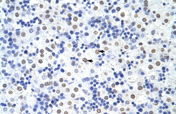 HNRPUL1 Rabbit Polyclonal Antibody