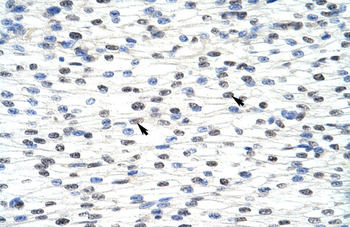 ADAT1 Rabbit Polyclonal Antibody