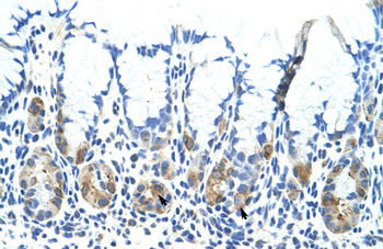 ADAT1 Rabbit Polyclonal Antibody