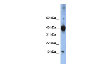 LSM4 Rabbit Polyclonal Antibody