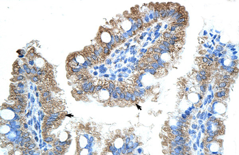 GTPBP9 Rabbit Polyclonal Antibody