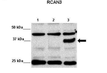 RCAN3 Rabbit Polyclonal Antibody