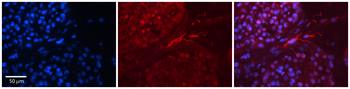 EWSR1 Rabbit Polyclonal Antibody
