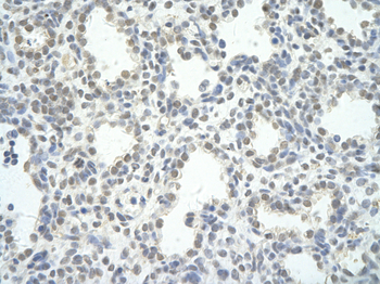 PPP1R8 Rabbit Polyclonal Antibody