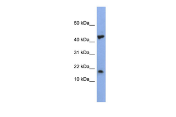 LSM1 Rabbit Polyclonal Antibody