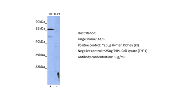 A1CF Rabbit Polyclonal Antibody