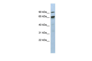 KIAA0427 Rabbit Polyclonal Antibody