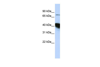 KIAA0427 Rabbit Polyclonal Antibody