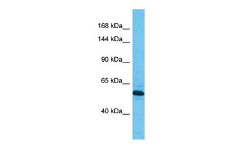 DIS3 Rabbit Polyclonal Antibody