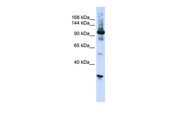 DIS3 Rabbit Polyclonal Antibody