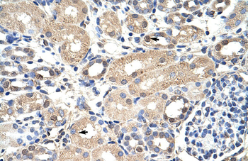 EXOSC7 Rabbit Polyclonal Antibody