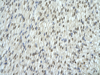 EXOSC7 Rabbit Polyclonal Antibody