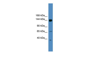 UPF2 Rabbit Polyclonal Antibody