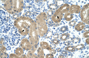 TRNT1 Rabbit Polyclonal Antibody
