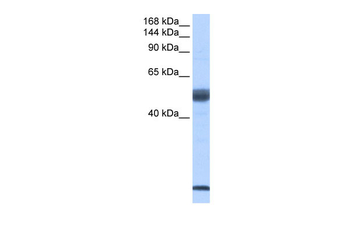 SF3B6 Rabbit Polyclonal Antibody
