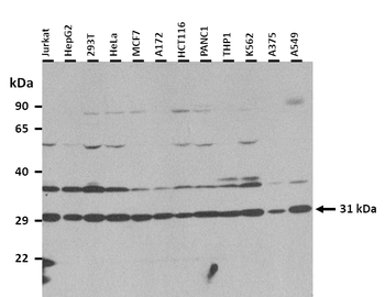 RBM7 Rabbit Polyclonal Antibody