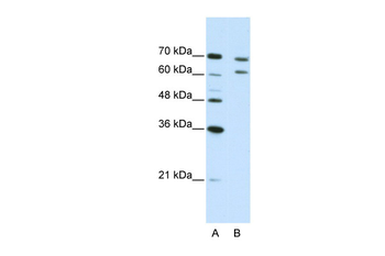 CPSF3 Rabbit Polyclonal Antibody