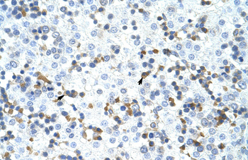 CPSF3 Rabbit Polyclonal Antibody
