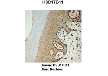HSD17B11 Rabbit Polyclonal Antibody