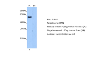 OAS2 Rabbit Polyclonal Antibody