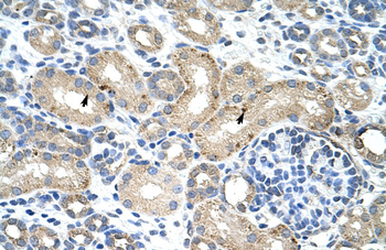 RBM38 Rabbit Polyclonal Antibody