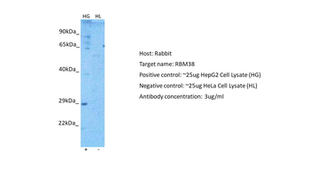 RBM38 Rabbit Polyclonal Antibody