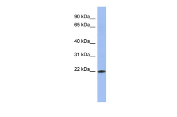 RBM38 Rabbit Polyclonal Antibody