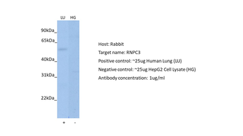 RNPC3 Rabbit Polyclonal Antibody