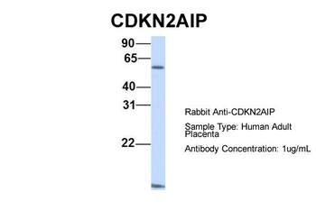 CDKN2AIP Rabbit Polyclonal Antibody