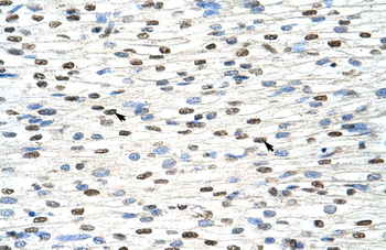 NXF3 Rabbit Polyclonal Antibody