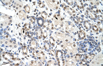 NXF3 Rabbit Polyclonal Antibody