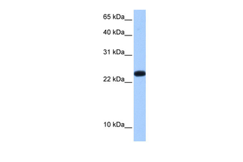 C19orf24 Rabbit Polyclonal Antibody