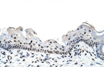 RBM28 Rabbit Polyclonal Antibody