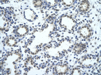 SRBD1 Rabbit Polyclonal Antibody